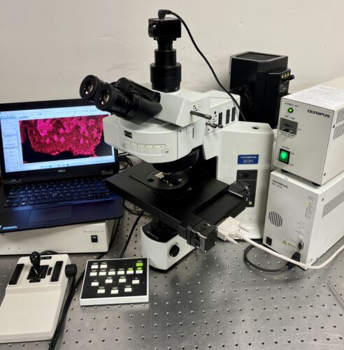 Olympus BX51 Fluorescence Prior Proscan 2 Scanning Microscope 5MP Cam ...